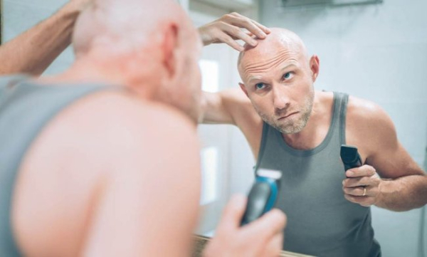 Чому чоловіки рано лисіють